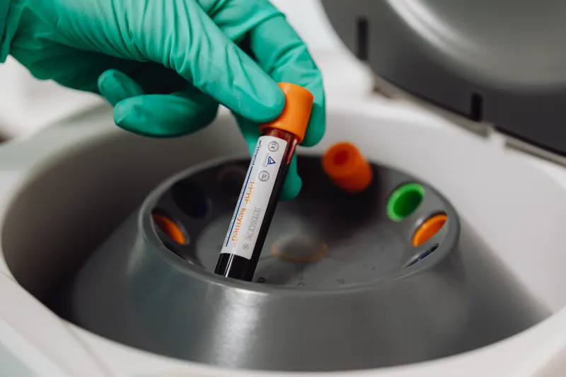 Biological Age Tests: What They Actually Measure